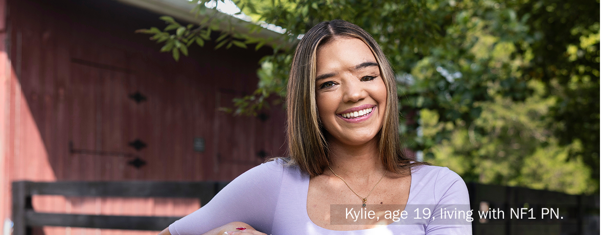 Kylie, age 19, leaning on a fence and smiling at the camera. Kylie takes Koselugo for NF1 PN.