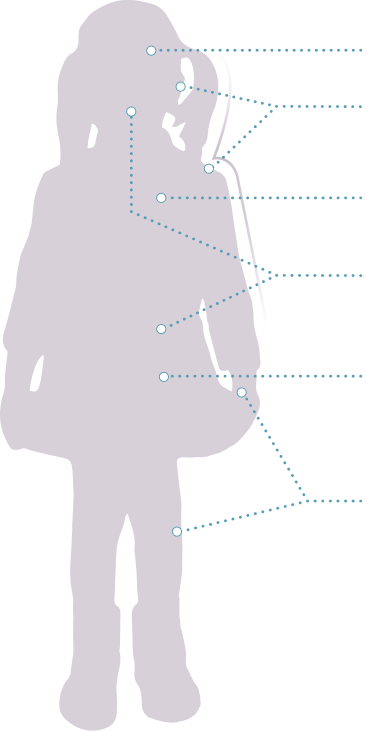 Outline of a child's body showing possible NF1 PN symptoms