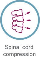icon_spinal_cord_compression